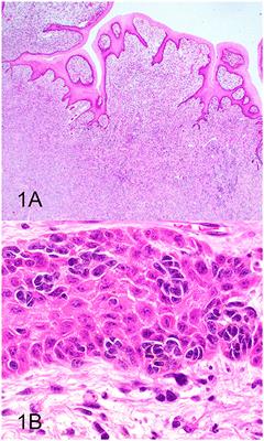 Quantitative Expression of TYR, CD34, and CALD1 Discriminates Between Canine Oral Malignant Melanomas and Soft Tissue Sarcomas